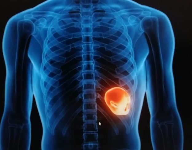 Psihosomatika ledvic